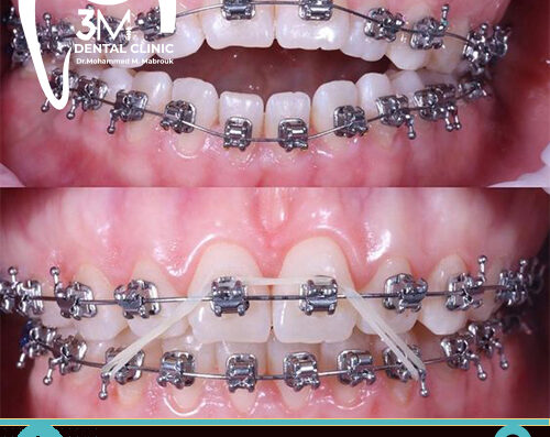 د/ محمد مبروك