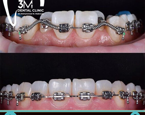 د/ محمد مبروك