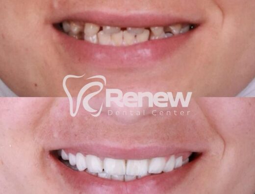 Renew Dental Center