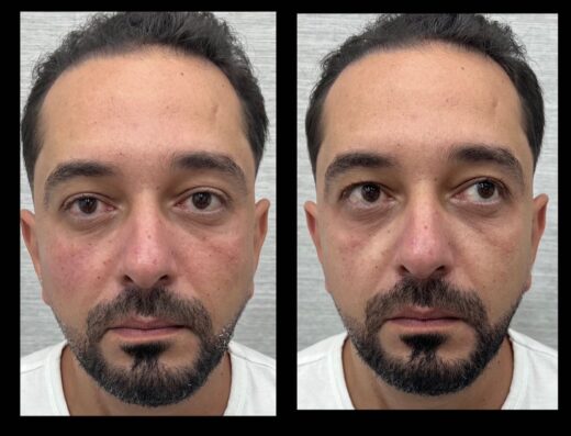 د ـ امنية العبد