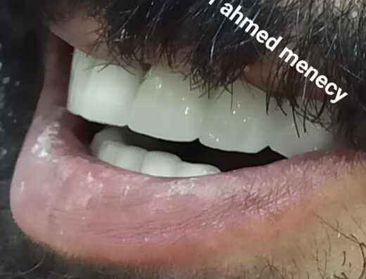 Ahmed Menecy