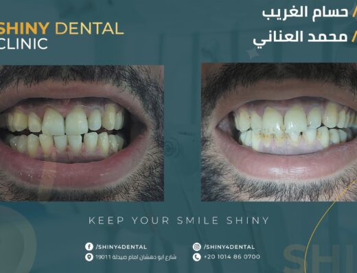 Shiny Dentel Clinic