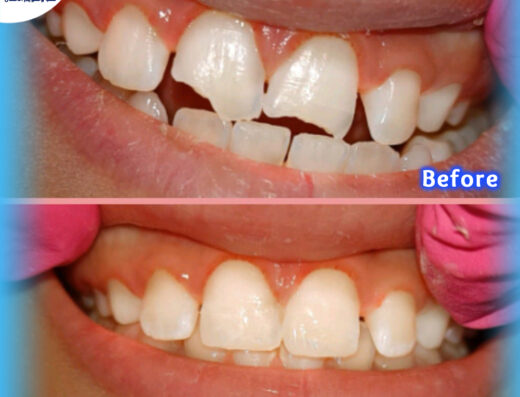 Royal Smile Dental Care