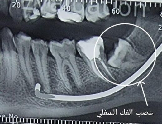 دكتور أحمد العريان 