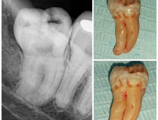 Zero Dental Clinic