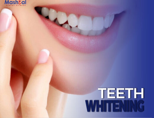 Mashaal Dental Clinics