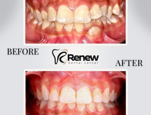 Renew Dental Center