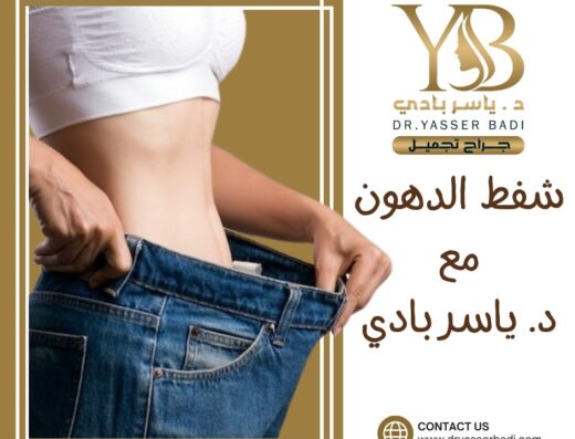 د.ياسر بادي