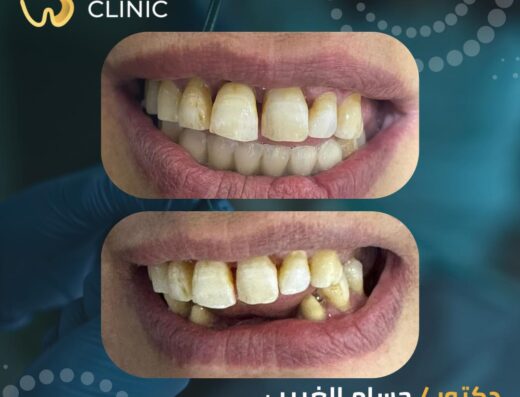 Shiny Dentel Clinic