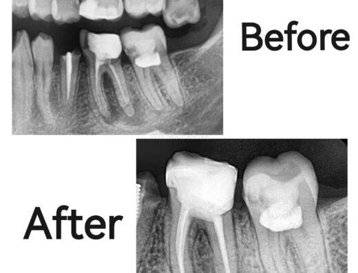 Zero Dental Clinic