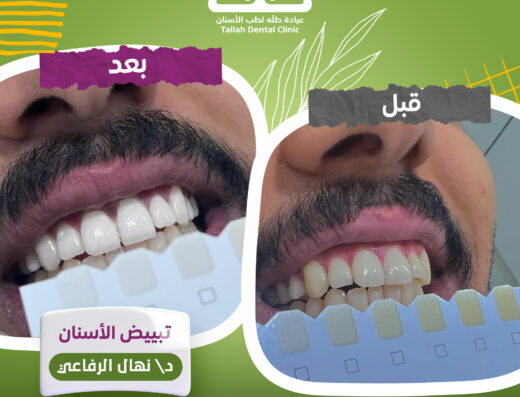Tallah Dental Clinic