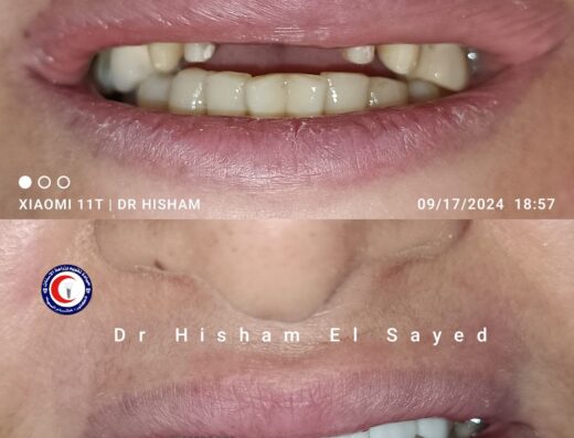 Dr Hisham El Sayed