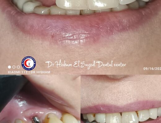 Dr Hisham El Sayed
