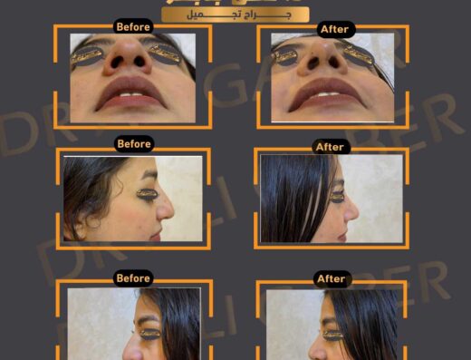 Dr. Ali Gaber Plastic Surgeon
