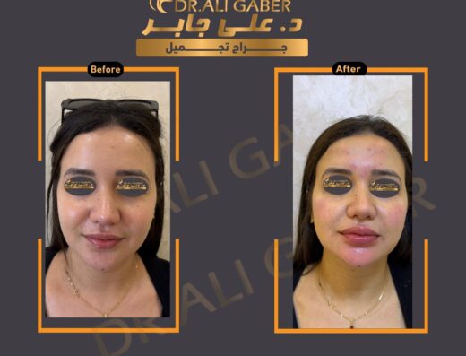 Dr. Ali Gaber Plastic Surgeon