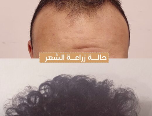 د أحمد عوض