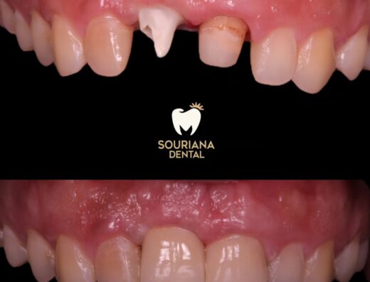 Souriana Dental Center