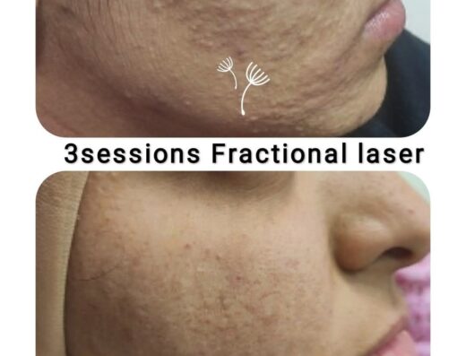 د ـ مى عبدالهادى