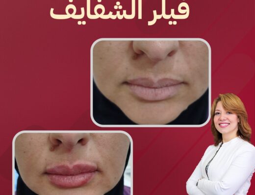د/ ماريان فيكتور