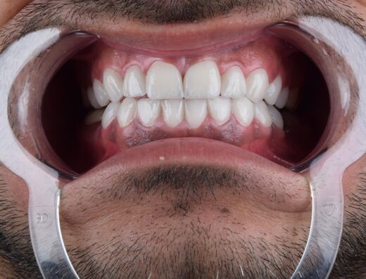 Smile Expertz Dental Clinic