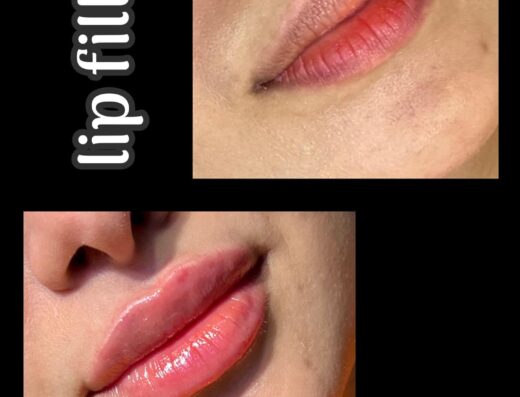 د ـ امنية العبد