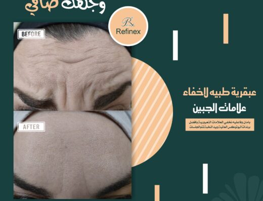 سيلين كلينك