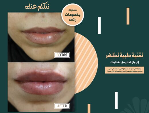 سيلين كلينك