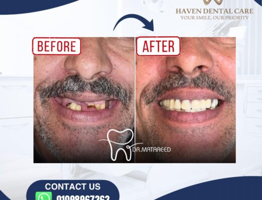 Haven Dental Care