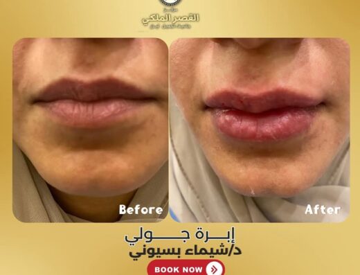 مركز القصر الملكي