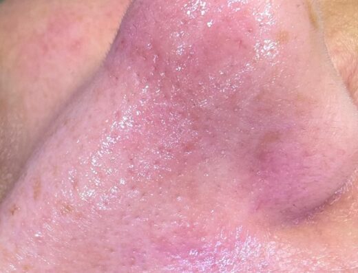 Nour.Hani-Skin Care