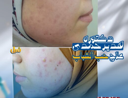 مركز مصر لليزر