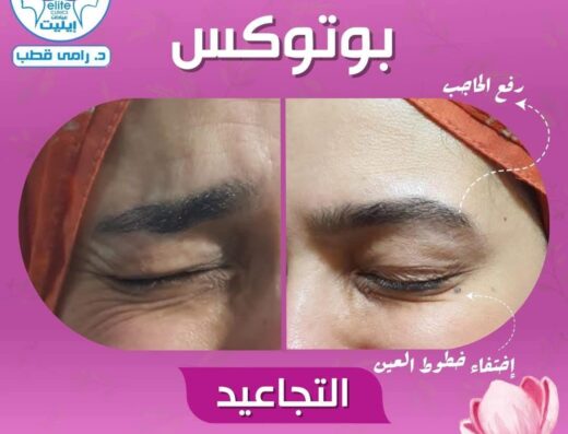 عيادات إيليت د. رامي قطب