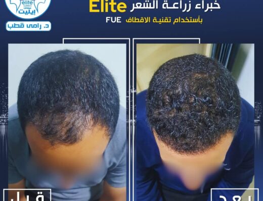 عيادات إيليت د. رامي قطب