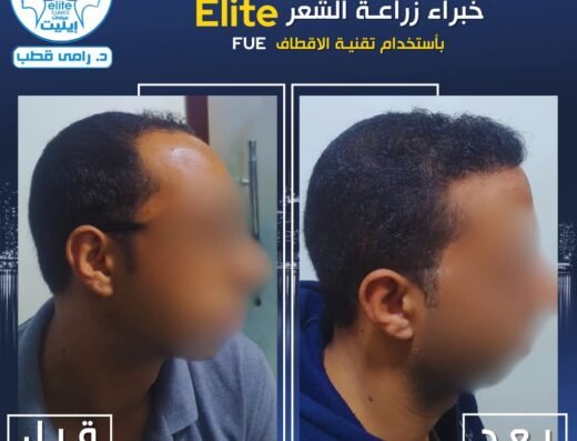 عيادات إيليت د. رامي قطب