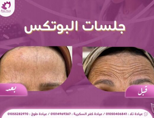 دكتورة رنا نزيه