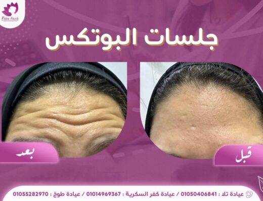 دكتورة رنا نزيه