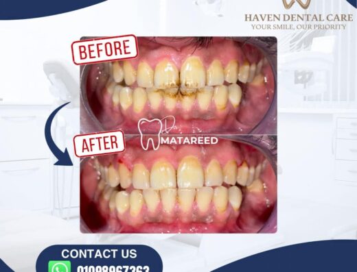 Haven Dental Care
