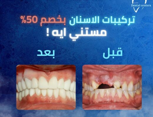 Candle dental centers