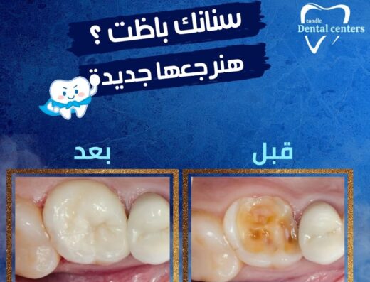 Candle dental centers