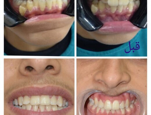 جاردنت لطب الأسنان