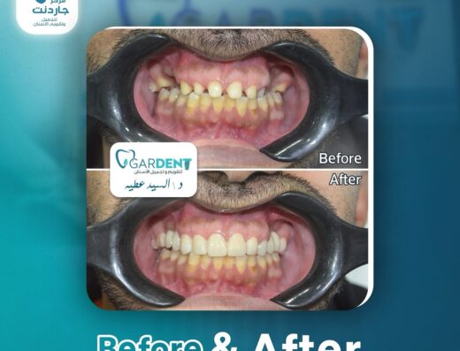 جاردنت لطب الأسنان