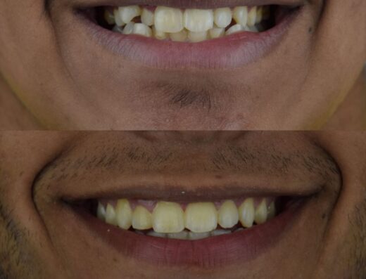 Dr.Hamza Elgendy Dental Clinic