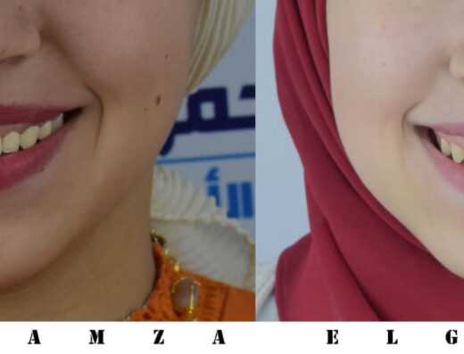 Dr.Hamza Elgendy Dental Clinic