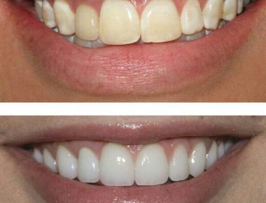 د/ رامى جريش