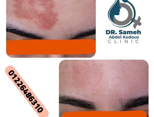 دكتور سامح عبد القدوس