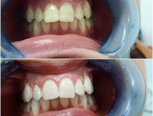 Ultradent Dr.Amr Mahmoud