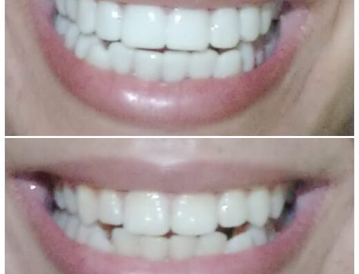 Ultradent Dr.Amr Mahmoud