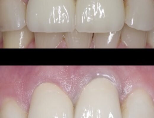 Ultradent Dr.Amr Mahmoud