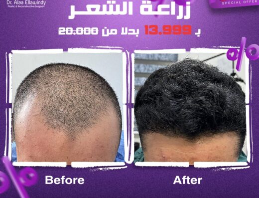 د. علاء اللاوندي