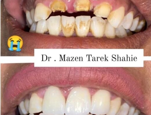 Dr Mazen Tarek Shahien Dental Care Clinic 